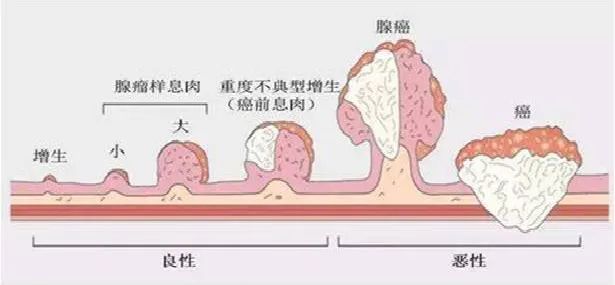 2024美国癌症协会权威发布：癌症死亡率大幅下降，做到这几点是关键！